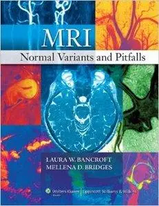 MRI Normal Variants and Pitfalls (Repost)