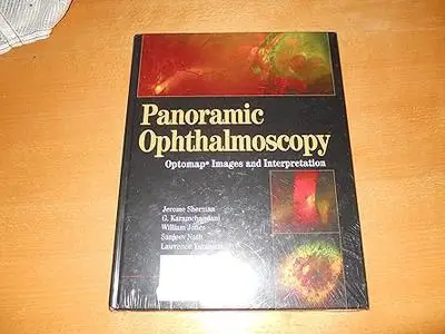 Panoramic Ophthalmoscopy: Optomap Images and Interpretation