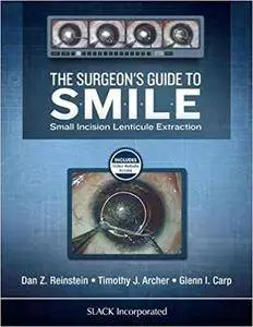 The Surgeon’s Guide to SMILE