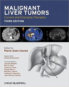 Malignant Liver Tumors: Current and Emerging Therapies Ed 3