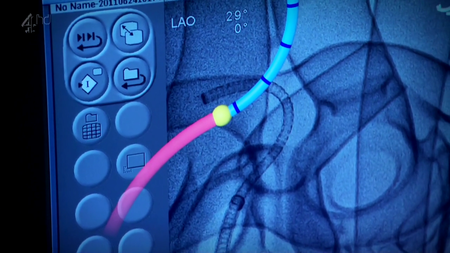 Channel 4 - Brave New World with Stephen Hawking S01E02: Health (2011) [repost]