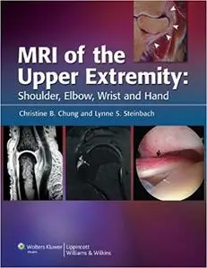 MRI of the Upper Extremity: Shoulder, Elbow, Wrist and Hand (Repost)