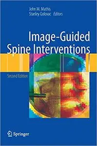 Image-Guided Spine Interventions Ed 2