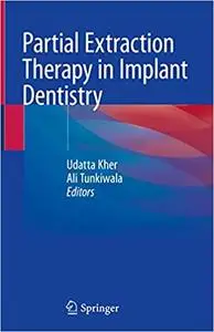 Partial Extraction Therapy in Implant Dentistry