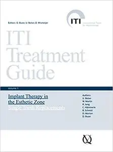 Iti Treatment Guide, Vol 1: Implant Therapy in the Esthetic Zone: Single-Tooth Replacements