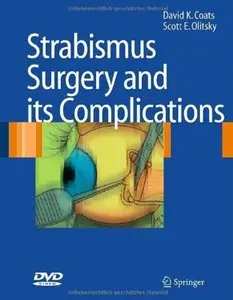 Strabismus Surgery and its Complications [Repost]