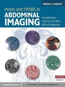 Pearls and Pitfalls in Abdominal Imaging: Pseudotumors, Variants and Other Difficult Diagnoses