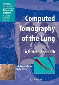 Computed Tomography of the Lung: A Pattern Approach