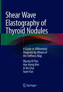 Shear Wave Elastography of Thyroid Nodules: A Guide to Differential Diagnosis by Means of the Stiffness Map