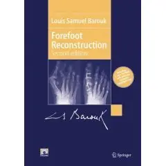 FOREFOOT RECONSTRUCTION