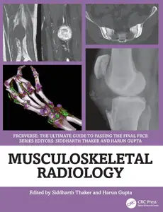 Musculoskeletal Radiology: An Ultimate Guide to Passing the Final FRCR (FRCRverse)
