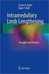 Intramedullary Limb Lengthening: Principles and Practice