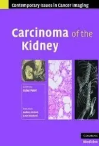 Carcinoma of the Kidney (repost)