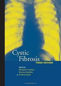 Cystic fibrosis