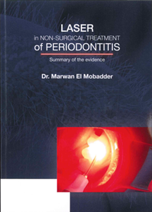 Laser in Non-Surgical Treatment of Periodontitis : Summary of the Evidence, Simply Explained
