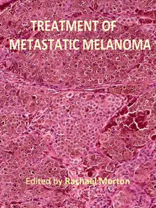 "Treatment of Metastatic Melanoma" ed. by Rachael Morton