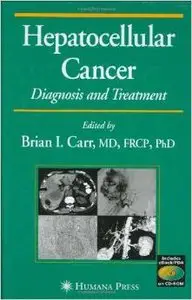 Hepatocellular Carcinoma: Diagnosis and Treatment, Second Edition (Current Clinical Oncology) by Brian I. Carr