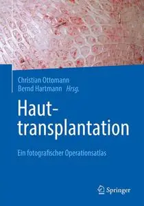 Hauttransplantation: Ein fotografischer Operationsatlas