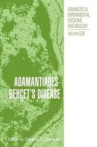 Adamantiades-Behçet’s Disease