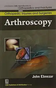 Arthroscopy