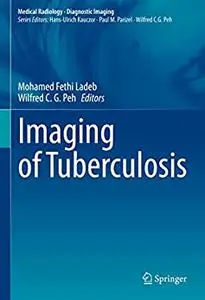 Imaging of Tuberculosis (Medical Radiology)