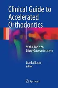 Clinical Guide to Accelerated Orthodontics: With a Focus on Micro-Osteoperforations [Repost]