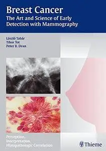 Breast Cancer: The Art and Science of Early Detection with Mammography