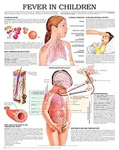 Fever in children e chart: Full illustrated