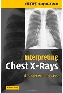 Interpreting Chest X-Rays: Illustrated with 100 Cases [Repost]