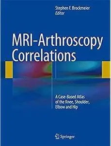 MRI-Arthroscopy Correlations: A Case-Based Atlas of the Knee, Shoulder, Elbow and Hip [Repost]