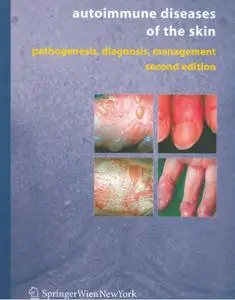 Autoimmune Diseases of the Skin: Pathogenesis, Diagnosis, Management