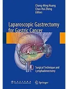 Laparoscopic Gastrectomy for Gastric Cancer: Surgical Technique and Lymphadenectomy [Repost]