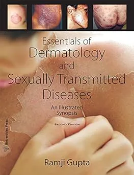 Essentials Of Dermatology And Sexually Transmitted Disease: An Illustrated Synopsis