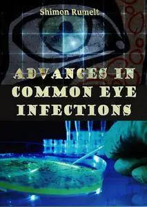"Advances in Common Eye Infections" ed. by Shimon Rumelt
