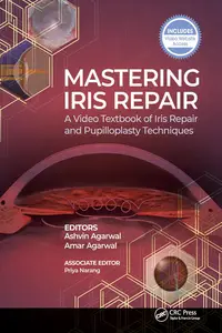 Mastering Iris Repair: A Video Textbook of Iris Repair and Pupilloplasty Techniques