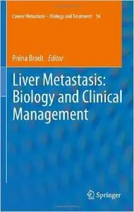 Liver Metastasis: Biology and Clinical Management (Repost)