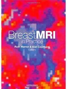 Breast MRI in Practice [Repost]