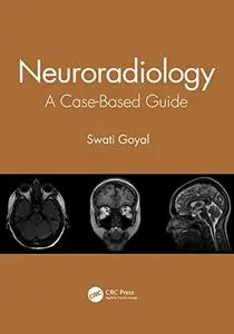 Neuroradiology: A Case-Based Guide