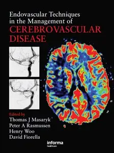 Endovascular Techniques in the Management of Cerebrovascular Disease by Thomas J. Masaryk