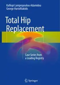 Total Hip Replacement: Case Series from a Leading Registry