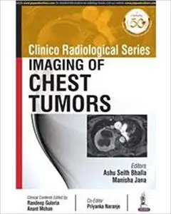 CLINICO RADIOLOGICAL SERIES IMAGING OF CHEST TUMORs