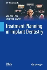 Treatment Planning In Implant Dentistry