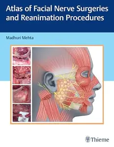 Atlas of Facial Nerve Surgeries and Reanimation Procedures