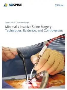 Minimally Invasive Spine Surgery (Repost)