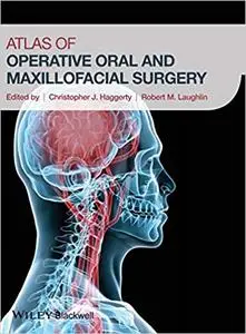 Atlas of Operative Oral and Maxillofacial Surgery