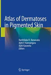 Atlas of Dermatoses in Pigmented Skin (Repost)