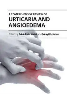 "A Comprehensive Review of Urticaria and Angioedema" ed. by Selda Pelin Kartal and Zekayi Kutlubay