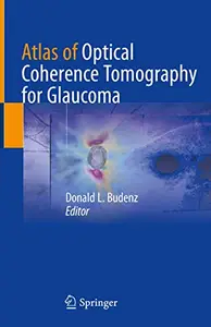 Atlas of Optical Coherence Tomography for Glaucoma (Repost)