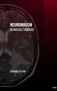 Neuroimagem de Massas Tumorais: Fernando Feltrin (Portuguese Edition)