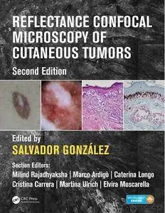 Reflectance Confocal Microscopy of Cutaneous Tumors, Second Edition